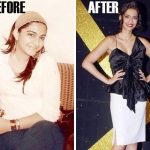 Sonam Kapoor Before and After