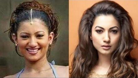 Gauahar Khan before and after lip surgery