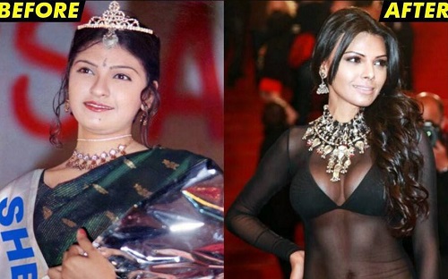 Before and after picture of Sherlyn Chopra
