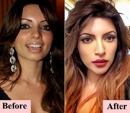 Shama Sikander's before and after picture