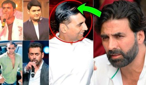 Bollywood Celebrities Who Underwent Hair Transplant