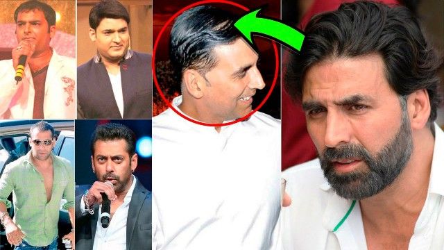 Bollywood Celebrities Who Underwent Hair Transplant