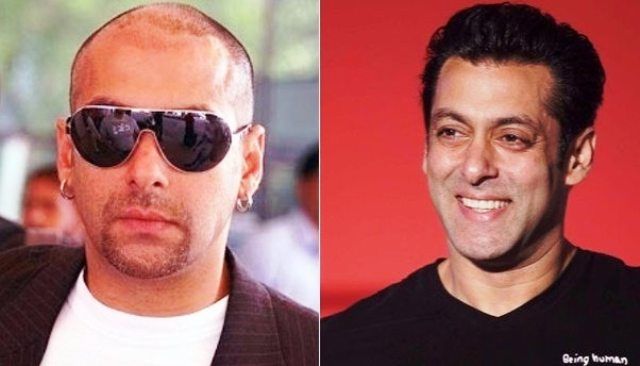 Bollywood Celebrities Who Underwent Hair Transplant » StarsUnfolded