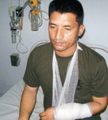 Injured Bishnu Shrestha