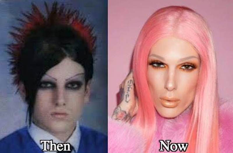 Jeffree Star before and after plastic surgeries