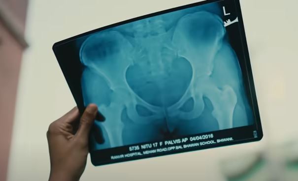 Nitu Ghanghas's X-ray copy, showing her pelvic injury