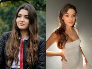 Hande Erçel before and after her physical transformation