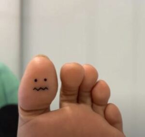 A grumpy face tattoo on the right foot's thumb