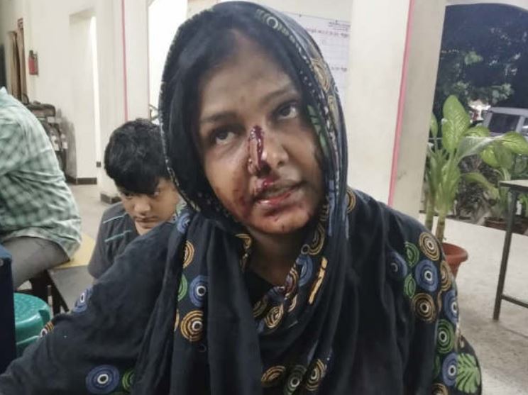 A picture of Mansoor Ali Khan's third wife, Waheeda, bleeding after a family dispute in 2018