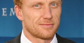 Kevin McKidd