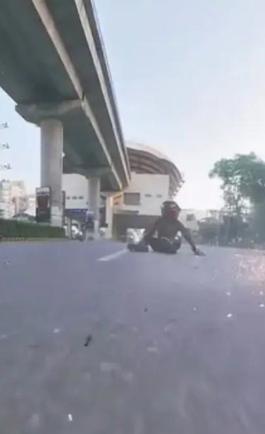 A picture of of Sia after she fell down from her bike